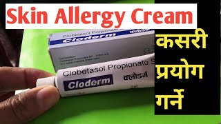 छाला चिलाएमा लगाउने मलमCream for Skin allergyMedicine for itching skincream for dermatitis [upl. by Tara]