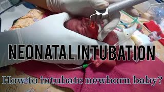 नवजात शिशु को intubate कैसे करें । How to intubate newborn baby doctorslife viral [upl. by Acinahs89]