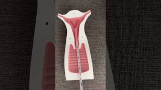 Copper t Online Simulation  IUD Procedure quot What is the Usesquot [upl. by Zsolway560]