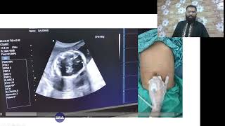 Lecture 1  Fetal Ultrasound Technique of Fetal USG in Second and Third Trimester  Iqramed Academy [upl. by Emory]