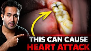 HIDDEN Cause of HEART ATTACK Nobody Knows About [upl. by Eresed]