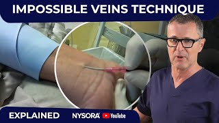 Difficult veins  Made Much Easier with this technique [upl. by Muscolo]