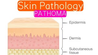 Skin Pathology PATHOMA 1  Introduction  Inflammatory Dermatosis [upl. by Ewall]