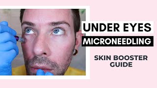 How To Microneedle Under Eye With PDRN Skin Booster  Curenex With Dr Pen Ft Vanidiy [upl. by Liatris]