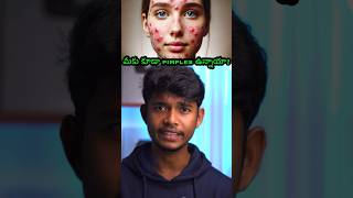 ✅Solution for Pimples osmdhruva telugu [upl. by Odarbil]