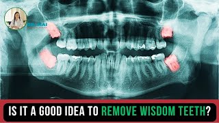 Part 74 Is it a good idea to remove wisdom teeth  DR MAI [upl. by Oivatco]