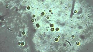 ZM Dunaliella salina phytoplankton culture [upl. by Lierbag157]