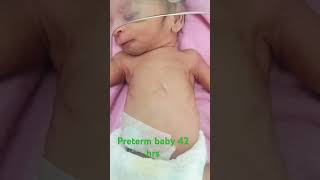 31weeksbabyneonatal newbornbaby cutebaby neonatalogy o2inhalatonbyhoodhospitalcare 1200gram [upl. by Nnitsuj443]