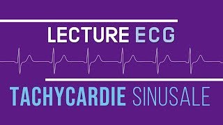 Interprétation ECG  Tachycardie Sinusale [upl. by Enairda]