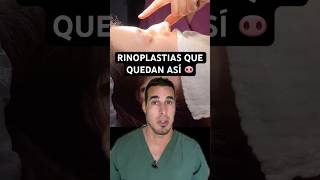 Se OPERAN la NARIZ y quedan PEOR 🐽  Esta RINOPLASTIA le cambió hasta los LABIOS [upl. by Yelhsa]