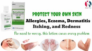 Betaderm Lotion uses benefits and side effects in UrduHindi [upl. by Leola]