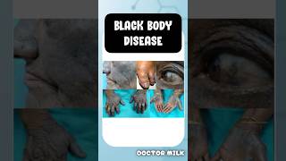 Black bone disease alkaptonuria neetpg usmle [upl. by Elem529]