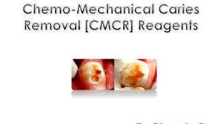 ChemoMechanical Caries Removal CMCR Reagents  Dr Ghousia [upl. by Torray718]