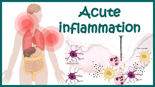 Acute Inflammation  symptoms Pathogenesis Cause of inflammation Mediators of Acute Inflammation [upl. by Kathrine]