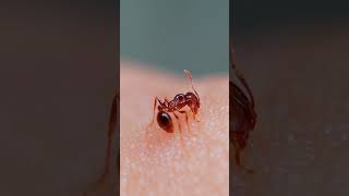 Fire ant bite and sting [upl. by Dobrinsky]