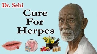 How Dr Sebi Cured Herpes  Complete Guide To Dr Sebi Cure For Herpes [upl. by Clint]