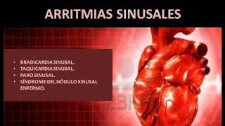 Arritmias sinusales  Fisiopatología [upl. by Netsua]