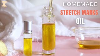 Fade Stretch Marks At Home With This Oil [upl. by Absalom]