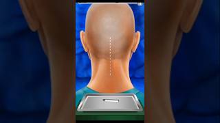 Back Head treatment shorts gaming viralvideo [upl. by Aivun]