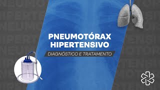 Pneumotórax Hipertensivo  Como Diagnosticar e Tratar [upl. by Ydok]