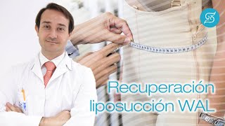 ¿Cómo es la recuperación de liposucción WAL [upl. by Ainotal]