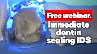 Immediate Dentin Sealing IDS Free webinar [upl. by Argyres564]