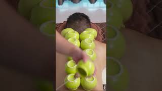 ASMR 火罐🔥  Cupping Therapy  Massage Body [upl. by Adnolaj318]