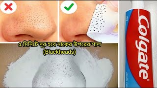 মাত্র ৫ মিনিটে দূর হবে নাকের উপরের শাল  মাত্র একবার ব্যবহার করেই পান ফলাফল  Beauty and health tips [upl. by Elatan698]