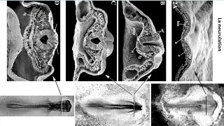 La troisième semaine du développement embryonnaire deuxième partie La neurulation [upl. by Annairam]