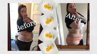 I LOST 20 LBS IN 10 DAYS  Only Egg Fast Almost with Hashimotos Hypothyroidism [upl. by Flita841]