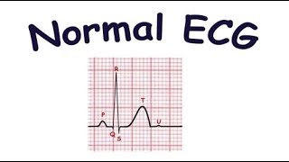 Normal ECG Kya hai  ECG ki Pehchan [upl. by Liba]