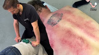 Chiropractor PUTS Full Weight 😳 Into Mans Back To Loosen Tight Joints  Gua Sha amp A CRUNCHY NECK [upl. by Seys]