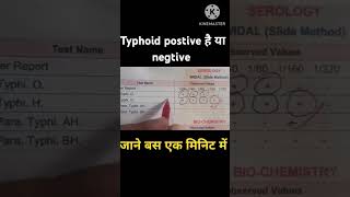 Widal test report देखे बस एक मिनिट में  widaltestreport widaltest widal typhoid typhoidfever [upl. by Godewyn]