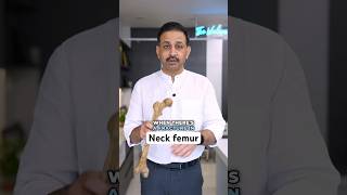 What’s Neck femur fracture नैक फीमर फ्रैक्चर क्या होता हैshortsvideo hipfracture hipreplacement [upl. by Berstine674]