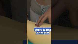 How to dry needle the fibularis longus [upl. by Alenas211]