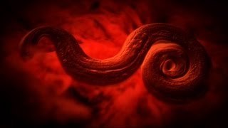 Rat Lung Worm Disease  Monsters Inside Me Ep8 [upl. by Onin]