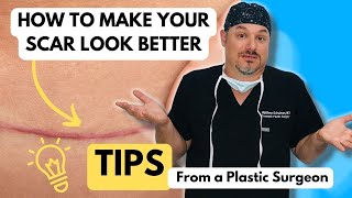 Tips for Treating Scars [upl. by Eeliak]