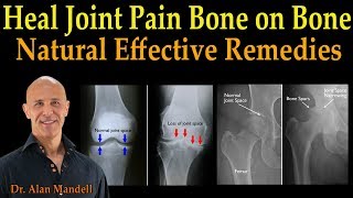 Heal Joint Pain Bone on Bone  Dr Alan Mandell DC [upl. by Norah]