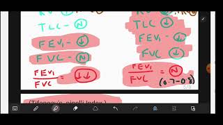 SPIROMETRY  Obstructive Vs Restrictive Lung Diseases  EASY Explained and Mnemonics  neetpg [upl. by Litnahc]