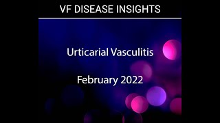 Urticarial Vasculitis Overview [upl. by Odrareve]