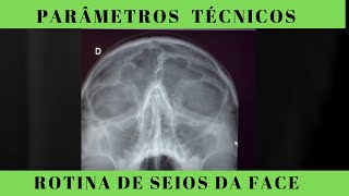 Radiografia de seios da face Como saber se meu exame ficou bom ANATOMIA RADIOLÓGICA [upl. by Nnylamme]