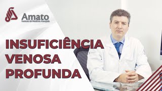 Insuficiência Venosa Profunda Varizes profundas [upl. by Novikoff]