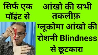 acupressure points for all eye problems eyesight vision improvement glaucoma eye pain itching hindi [upl. by Ettellocin]