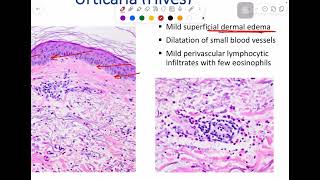 MSS pathology lab 1  part 1 [upl. by Craggy]