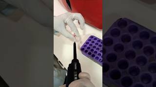 HBA1C TESTING hospital laboratorylife science medicallaboratory sciencelab lab [upl. by Neelyam]