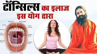 Right Way To Do Yoga  Swami Ramdev Ji  उज्जायी प्राणायाम के लाभ [upl. by Eerak353]