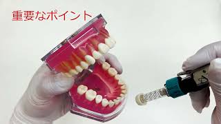 針なし注射器【Injex50公式】（歯科向け） 使用方法 【Injex50 Official】 How to use the dental injector [upl. by Alessig]