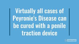 How a Traction Device can Treat Peyronies Disease [upl. by Abraham]