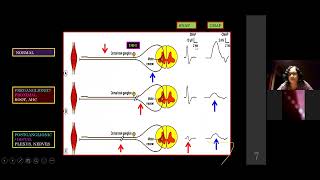 NERVE CONDUCTION STUDIES CRASH COURSE 1 Dr Radhika Manohar [upl. by Zingg]