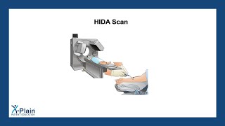 HIDA Scan [upl. by Hnib]